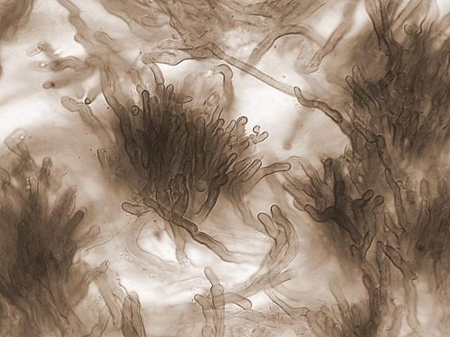 Xeromphalina cauticinalis   (Fr.)  Khner & Maire